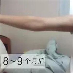 手臂吸脂手術(shù)八個月了，看看我的前后對比果圖片吧~~