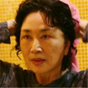 做面部拉皮除皺手術(shù)半年多了，看看我的恢復過程照片吧，果不錯~