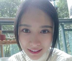 自體脂肪面部填充三個(gè)月了，恢復(fù)的很好，給你們看看果怎么樣吧，是不是很美麗了~