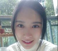 大腿吸脂做自體脂肪面部填充三個月了，分享給大家