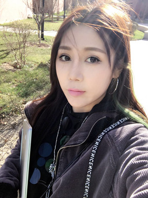 周長(zhǎng)兵給我做的隆鼻整形恢復(fù)得好自然