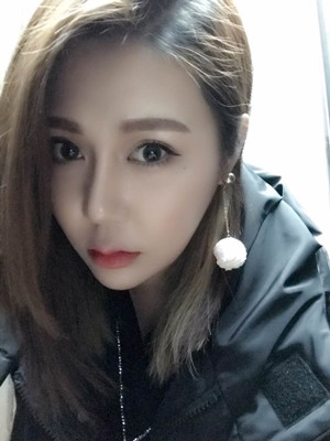 周長(zhǎng)兵給我做的隆鼻整形恢復(fù)得好自然