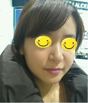 光子嫩膚后，整個(gè)人漂亮多了