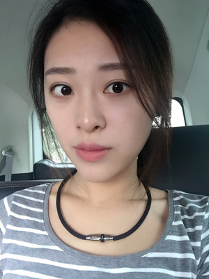 翟爽給我打玻尿酸隆鼻做出了假體的感覺