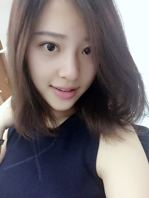 翟爽給我打玻尿酸隆鼻做出了假體的感覺