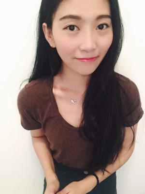 隆鼻手術(shù)前后過(guò)程對(duì)比圖，真實(shí)案例分享