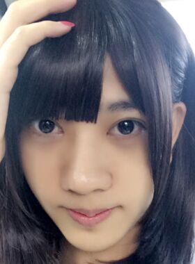 大鼻子做了隆鼻整形后終于變秀氣了