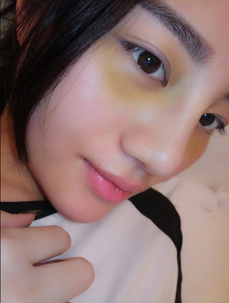 隆鼻整形手術(shù)拯救了我的低顏值