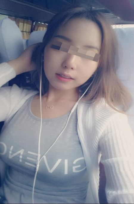 小胸和大胸就差一個李鴻君做的假體隆胸手術(shù)