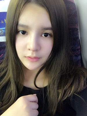 做完膨體隆鼻后臉型都變得好看了