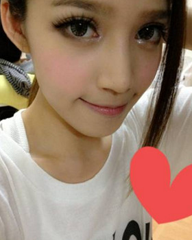 記錄了隆鼻三個(gè)月前后的恢復(fù)過(guò)程，希望可以幫到有需要的朋友