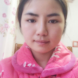 磨骨磨下頜角半年了，分享恢復(fù)過(guò)程和前后對(duì)比果照片哦~