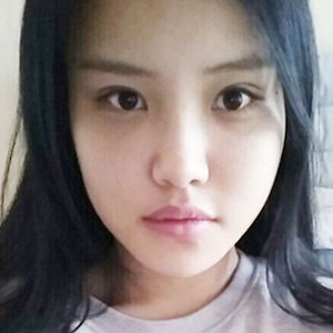 做下頜角整形手術(shù)半年了，給你們看看恢復(fù)過(guò)程照片吧~