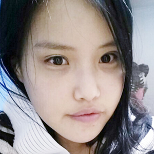 做下頜角整形手術(shù)半年了，給你們看看恢復(fù)過(guò)程照片吧~