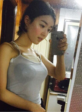 假體隆胸手術(shù)恢復(fù)過程分享，還有前后對比照片哦