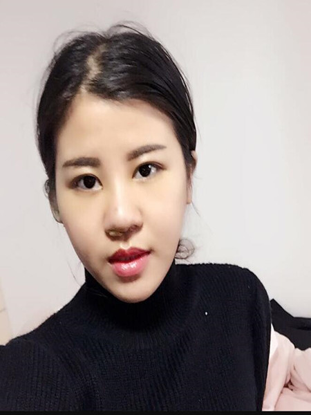 終于做里隆鼻整形手術 快來圍觀我時候果吧