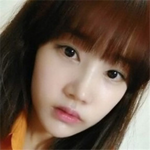 做地包天矯正手術(shù)五個月了，恢復(fù)得不錯，有前后對比果圖片哦~