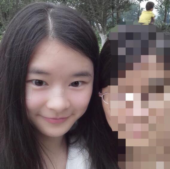 分享手術(shù)切除祛疤恢復(fù)過程希望對大家有幫助