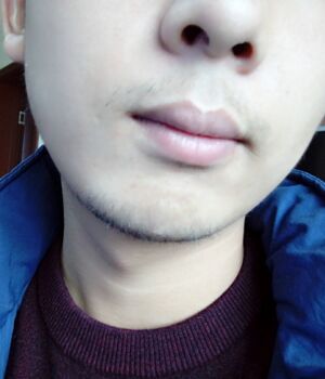 胡須種植后長出來的胡子較為滿意