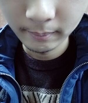 胡須種植后長出來的胡子較為滿意