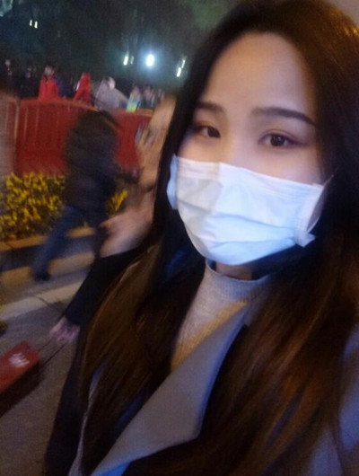 全切雙眼皮讓我告別腫泡眼變女神