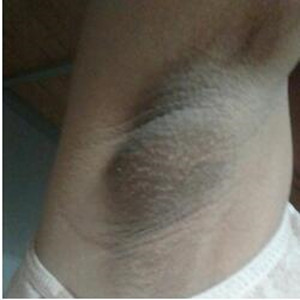 我自身去狐臭的真實(shí)經(jīng)歷 你不去試過怎么會知道果了