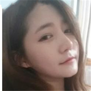 去年做的雙眼皮，分享恢復(fù)過程和前后對比果圖片~