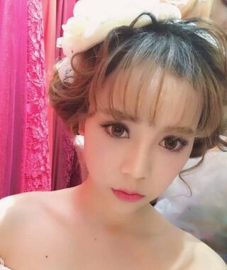 尹度龍醫(yī)生做的雙眼皮無比的自然美麗