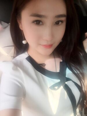 膨體隆鼻改變了我的塌鼻子，整體都精致不少