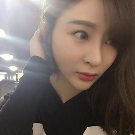 自體脂肪填充面部前后過(guò)程以及對(duì)比照片，真實(shí)案例分享