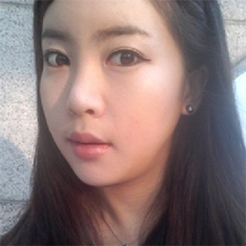 分享美立方做下頜角整形手術(shù)經(jīng)歷，還有前后對比果圖片哦~