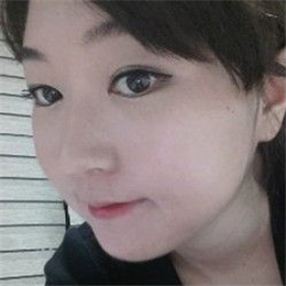 下頜角整形手術(shù)前后對比果圖片分享，還有恢復(fù)過程心路歷程~~~