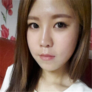 藝星做的玻尿酸去法令紋，分享恢復過程和前后對比照片~