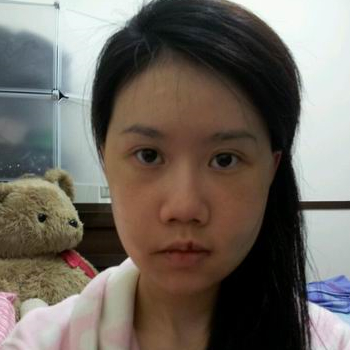 磨下頜角面部輪廓整形上個月，分享恢復(fù)過程和對比照片哦~