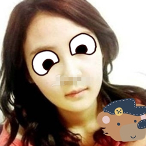 南相宰磨下頜角手術(shù)恢復(fù)過程分享，還有前后對比圖片哦~