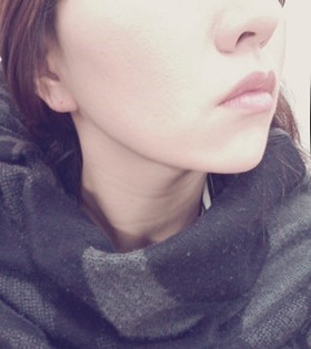 電波l皮緊膚除皺，的確是年輕了不少