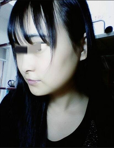 終于做了磨下頜角拯救了我的國字臉