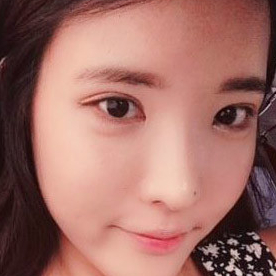 鷹鉤鼻矯正整形手術(shù)恢復(fù)過程和前后對比果圖片，分享給大家~