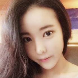 鷹鉤鼻矯正整形手術(shù)恢復(fù)過程和前后對比果圖片，分享給大家~