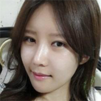 做了埋線雙眼皮、隆鼻、磨下頜角，兩個(gè)月了，分享恢復(fù)照片~