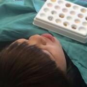 美容冠牙齒修復(fù)，緩解前后過(guò)程分享