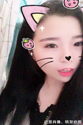 剛做了雙眼皮切開(kāi)重瞼手術(shù)，恢復(fù)得越來(lái)越自然了