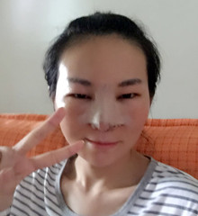 真人記錄了硅膠隆隆鼻整形手術(shù)前后過(guò)程，大家進(jìn)來(lái)看看吧!