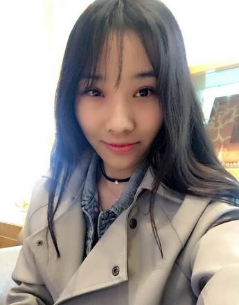 開(kāi)眼角加雙眼皮15天恢復(fù)圖