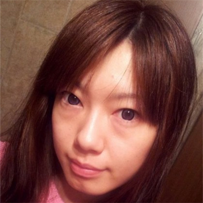 激光溶脂去眼袋恢復(fù)過程和前后對比果圖片分享哦~