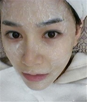 元旦做的光子嫩膚，分享恢復過程和前后對比果照片哦~