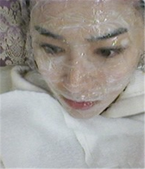 元旦做的光子嫩膚，分享恢復過程和前后對比果照片哦~