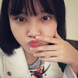 北京美萊做了雙眼皮手術(shù)，分享前后對比果圖片~