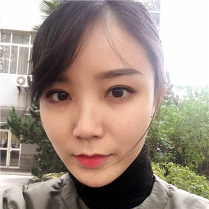 北京美萊做了雙眼皮手術(shù)，分享前后對比果圖片~