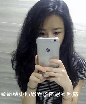 眉毛種植果和成長過程分享